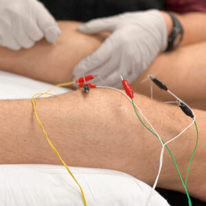 Dry Needling